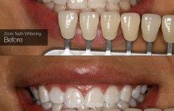 image-[object Object]