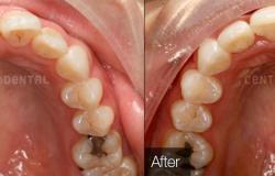 image-[object Object]