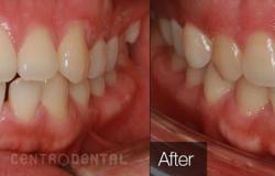 image-[object Object]