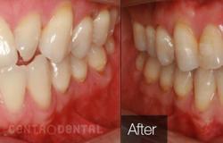 image-[object Object]