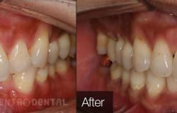 image-[object Object]