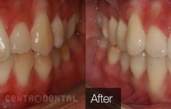 image-[object Object]