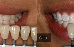 image-[object Object]