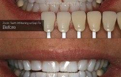 image-[object Object]