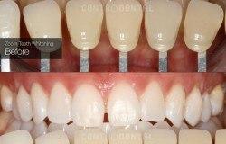 image-[object Object]