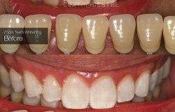 image-[object Object]